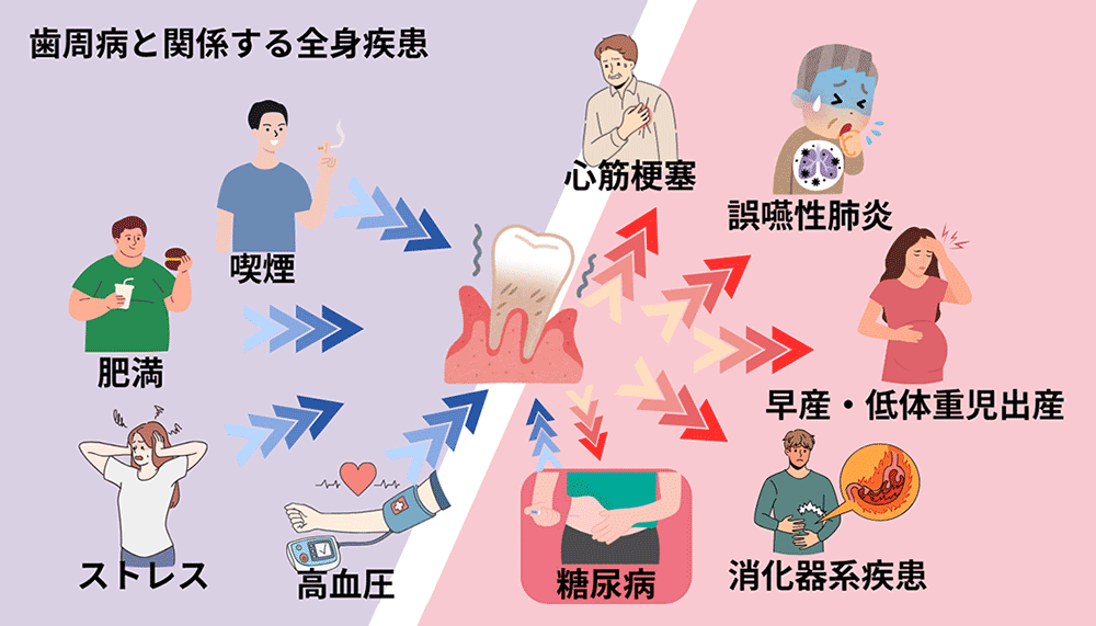 歯周病と関係する全身疾患
