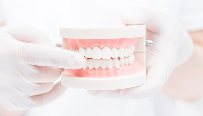 歯を削る量を最小限に