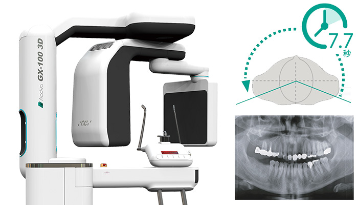 アーム型X線CT診断装置